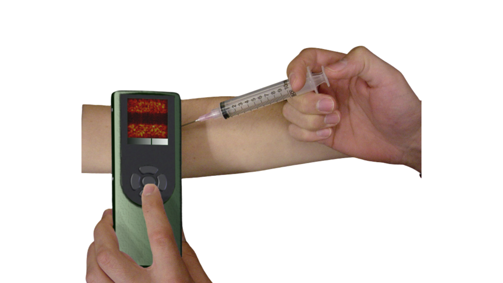 Handheld Ultrasound 2